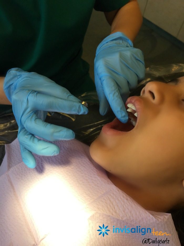 invisalign on teens