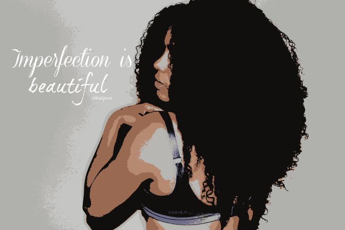 Imperfection is beautiful | La belleza de mis imperfecciones