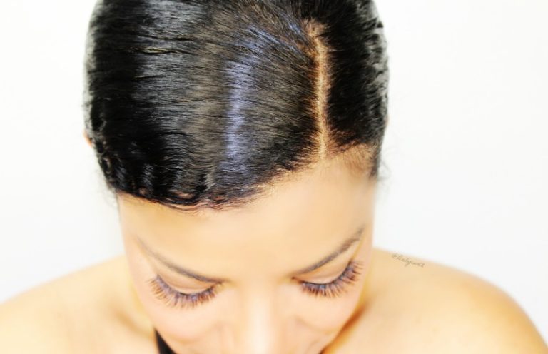 All you need to know about heredity hair loss| Todo lo que necesitas saber sobre la perdida de cabello.